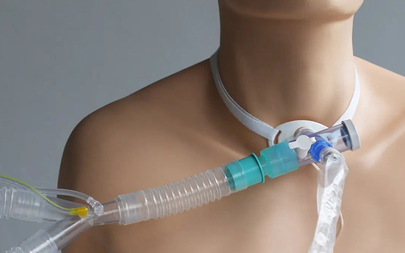 Cách giảm ho cho bệnh nhân có ống mở khí quản (tracheostomy)