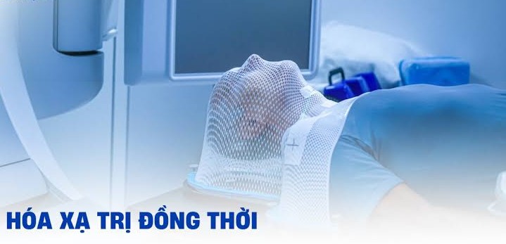 Hóa xạ trị đồng thời là phương pháp phối hợp hai liệu pháp điều trị toàn thân và tại chỗ nhằm tối đa hóa tỷ lệ kiểm soát bướu