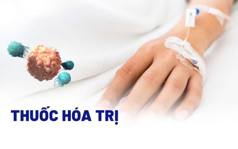 Làm sao để giảm mệt mỏi khi vào hóa trị (Cancer-Related Fatigue - CRF)