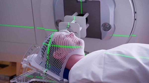 thông tin dành cho bệnh nhân xạ trị vùng đầu - mặt - cổ