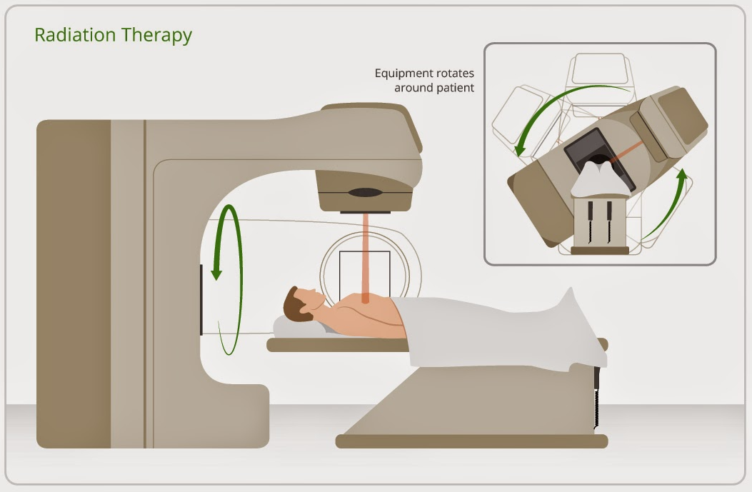 Xạ trị giảm đau cho bệnh nhân ung thư